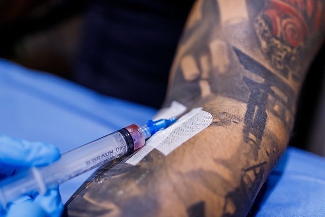 How IV Drip Therapy Works